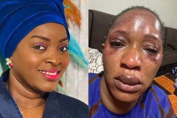 Aya Diawara à Djelykaba Bintou : « Pardonne-moi, si malgré la gravité de tes blessures, je ne lui ai fait aucun reproche »