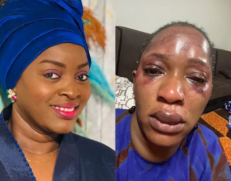 Aya Diawara à Djelykaba Bintou : « Pardonne-moi, si malgré la gravité de tes blessures, je ne lui ai fait aucun reproche »