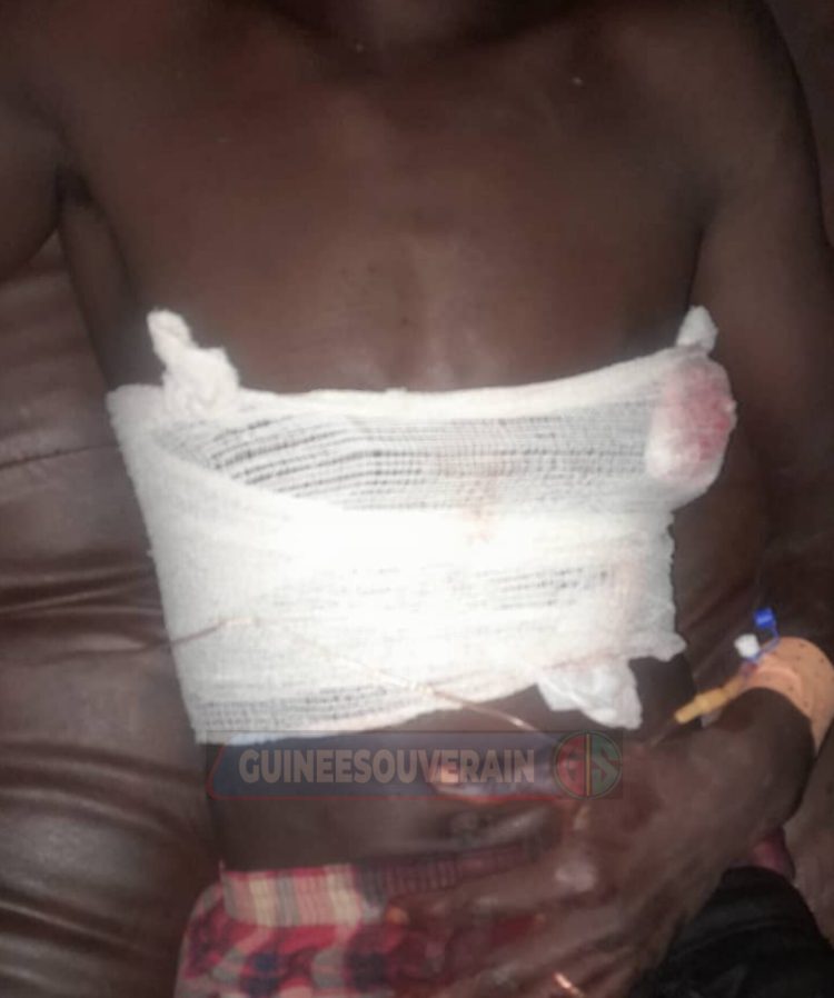 Insécurité à Siguiri : Mamadi Traoré, orpailleur, attaqué et sa machine emportée