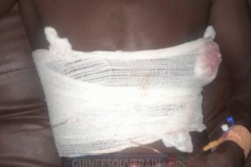 Insécurité à Siguiri : un jeune grièvement blessé lors d'une attaque à main armée à Dorah