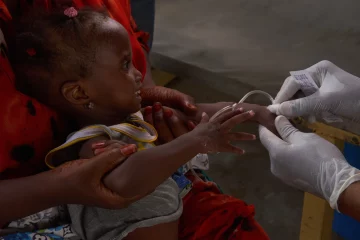 MAIDUGURI, Nigéria (AP) — Une épidémie de choléra dans le nord-est du Nigéria a tué 74 personnes et en a infecté plus de 7 000 autres depuis son début au début du mois de mai, a déclaré mardi l'organisation humanitaire médicale Médecins Sans Frontières. L’épidémie, signalée dans 14 des 27 zones de gouvernement local de l’État de Borno, se propage dans des communautés dont les systèmes de santé sont fragilisés par près de deux décennies d’extrémisme violent du groupe insurgé Boko Haram . La maladie est endémique et saisonnière dans le pays , où seulement 14 % de la population nigériane, qui compte plus de 200 millions d'habitants, a accès à des services d'approvisionnement en eau potable gérés en toute sécurité, selon les données gouvernementales de 2020. La situation est parfois pire à Borno, aussi bien à Maiduguri, la capitale de l'État, qui est densément peuplée, que dans les communautés reculées où l'assainissement et l'hygiène sont insuffisants, en partie parce qu'elles sont hors de portée des autorités sanitaires. Le groupe médical a indiqué avoir pris en charge 7 439 patients atteints du choléra dans ses établissements, soit une moyenne de 185 admissions par jour. Il a précisé avoir enregistré 500 cas vendredi dernier, un record journalier depuis le début de l'épidémie. « La défécation à l’air libre aggrave également la situation, et il y a moins de partenaires (sur le terrain) », a déclaré Jessie Kurnurkar, coordinatrice de projet chez Médecins Sans Frontières, connu sous son acronyme français MSF. « Au moment où nous prenons connaissance des cas dans la communauté, la transmission locale a déjà eu lieu et il est difficile de réagir, car la propagation s'est amplifiée », a déclaré Kurnurkar. Des patients d'un centre de traitement de MSF à Maiduguri ont témoigné auprès de l'Associated Press de leur expérience face à l'épidémie. Aisha Ibrahim, une patiente atteinte du choléra et hospitalisée dans cet établissement, a déclaré qu'elle déféquait sans cesse depuis qu'elle était tombée malade et qu'elle était admise depuis plus de quatre jours. « Quand ils m’ont laissé sortir, les vomissements ont cessé, et quand je suis rentré chez moi, j’ai recommencé à avoir des selles, et c’est devenu grave (donc) j’ai été ramené d’urgence au centre », a déclaré Ibrahim.