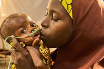 Nigeria dans le nord ouest, les habitants confrontés à la pauvreté et la malnutrition