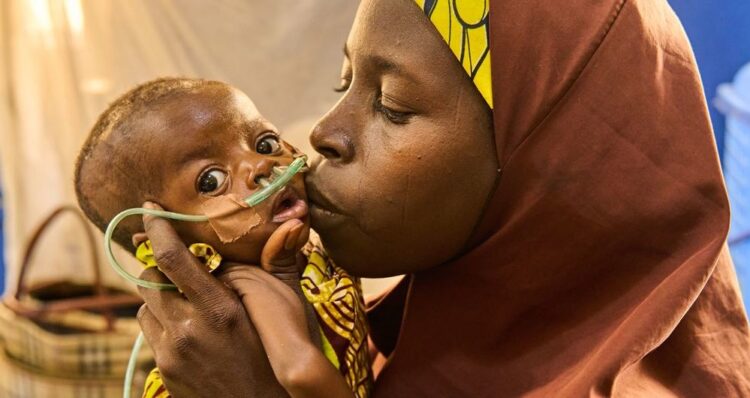 Nigeria dans le nord ouest, les habitants confrontés à la pauvreté et la malnutrition